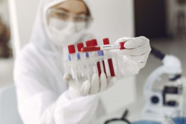 Prvi srpski test za kovid 19 efikasniji od PCR-a?
